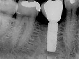 Zahntechnik Wiedmann Zahnlabor Zahnersatz Dentallabor Dentaltechnik Steinheim