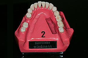 Zahntechnik Wiedmann Zahnlabor Zahnersatz Dentallabor Dentaltechnik Steinheim